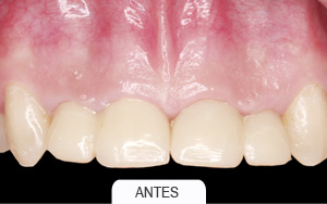 estética dental