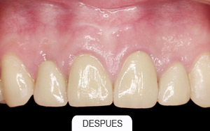 estética dental