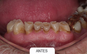 estética dental