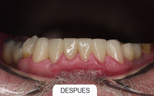 estética dental