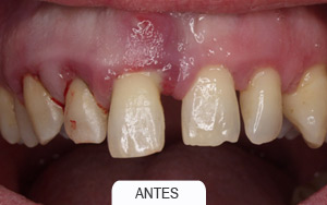 periodoncia